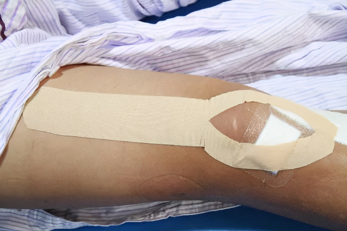 弹性贴布的原理,弹性贴布的作用