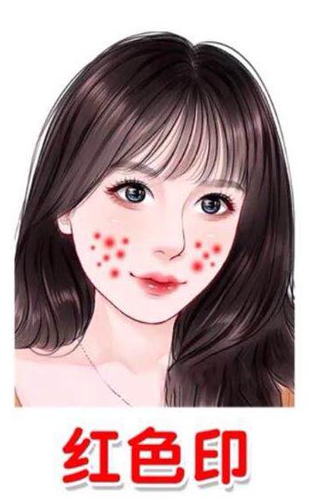 快速淡化痘印又简单的方法,怎样有效祛除痘印痘坑物理方法