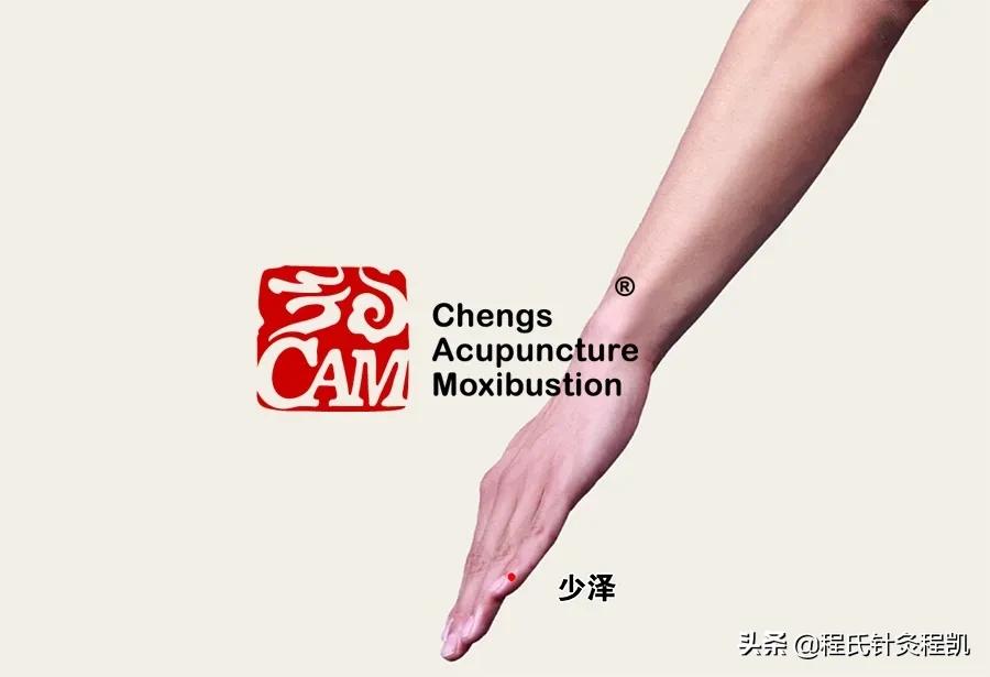 程凯医生讲养生,程凯养生说脑梗后怎么锻炼