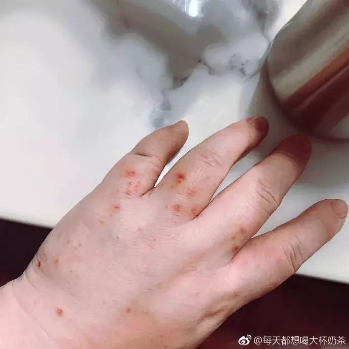 怀孕八个月吃海底捞有什么影响,怀孕想吃海底捞老公不陪我去吃