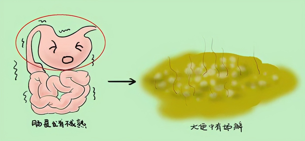 宝宝绿便用不用换奶粉,宝宝绿便需要补铁吗