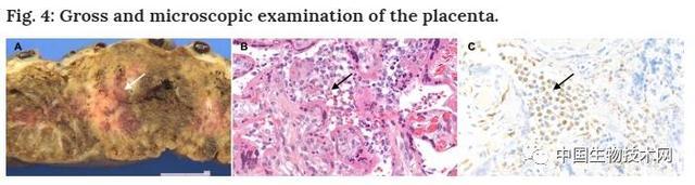 首例新型冠状病毒患者来源,首例新冠病毒