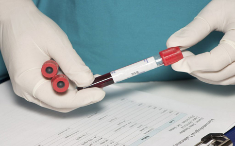 治疗乙肝中医还是西医效果好,乙肝为什么治不好医生说尽力了