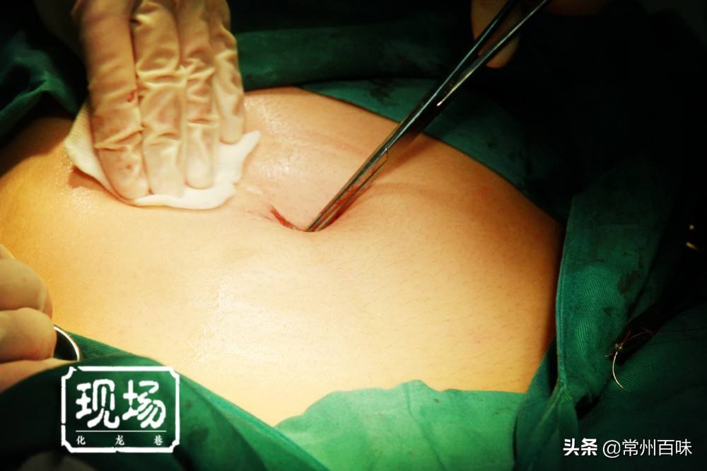 男妇产科医生被女患者排斥,妇产科男医生真实案例