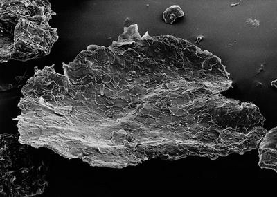 头皮屑是怎么产生的该怎么消除,头皮屑过多产生的原因和预防方法