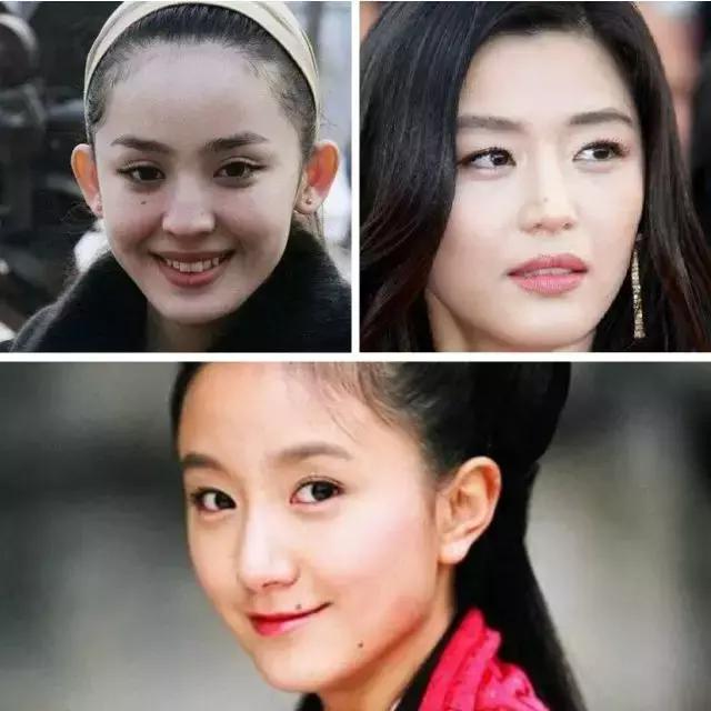 小孩子有痣怎么判断是否癌变,小孩脸上长痣会不会恶变