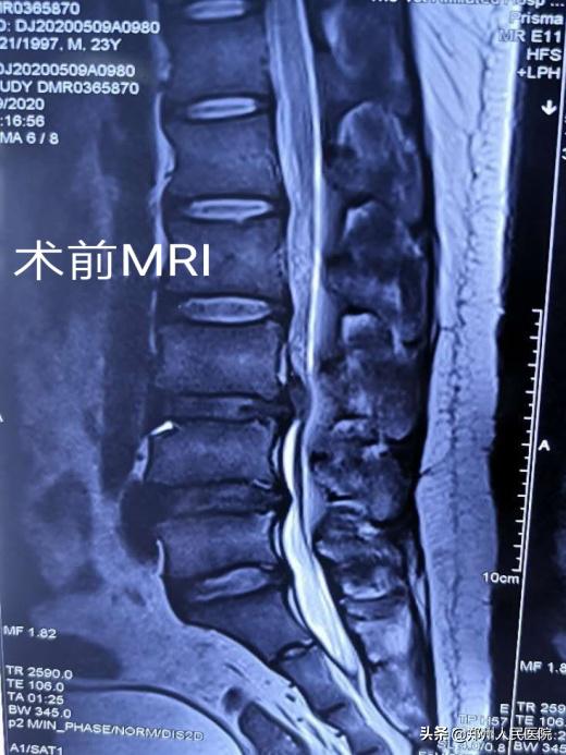 对骨科微创技术的认识,骨科手术与保守治疗对比