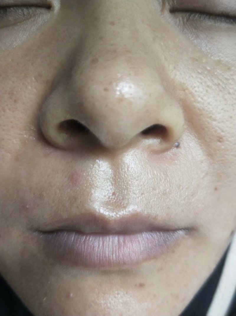 师说阅读参考答案,从舌象看妇科病