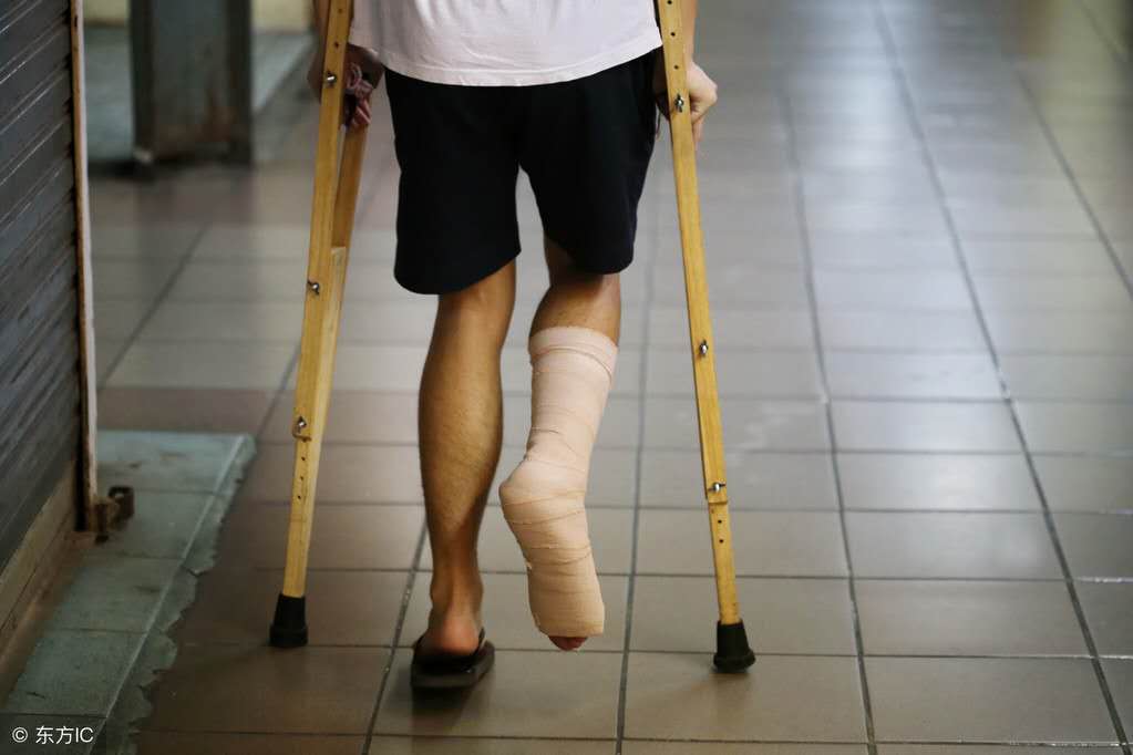 骨科打石膏视频,骨科病人打石膏