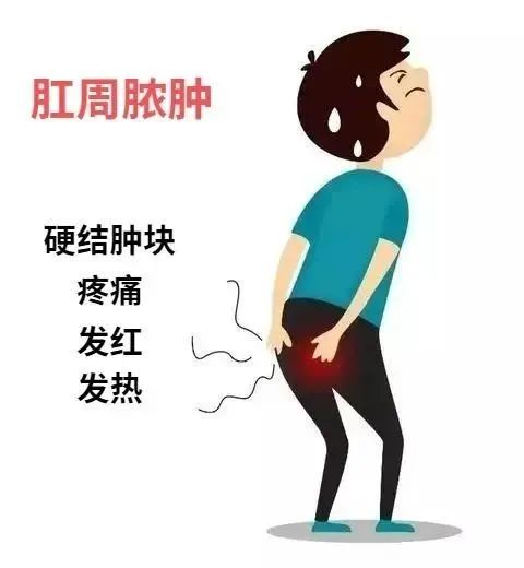 肛周脓肿自我判断方法,肛周脓肿能自我修复吗