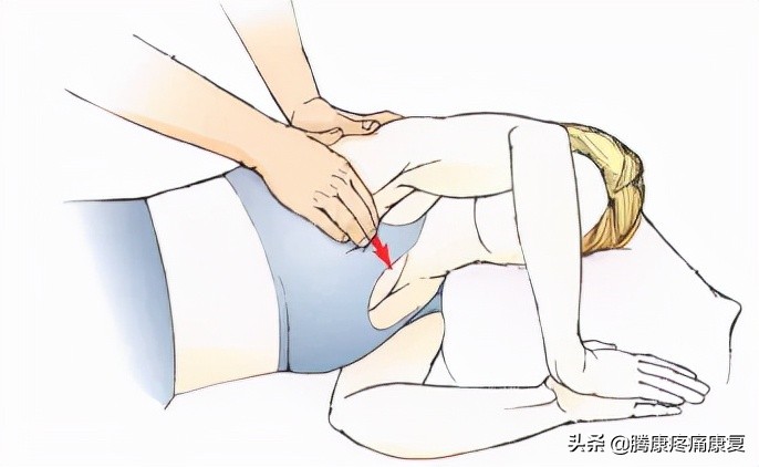 背阔肌综合征病历,背阔综合症