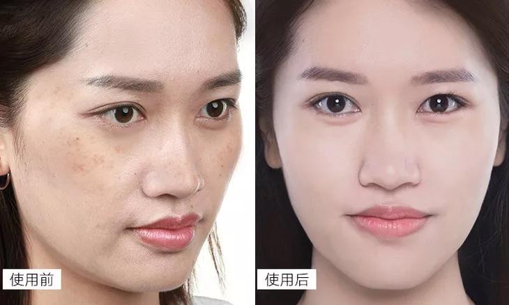 平价淡斑美白小灯泡,神仙水小灯泡精华淡斑