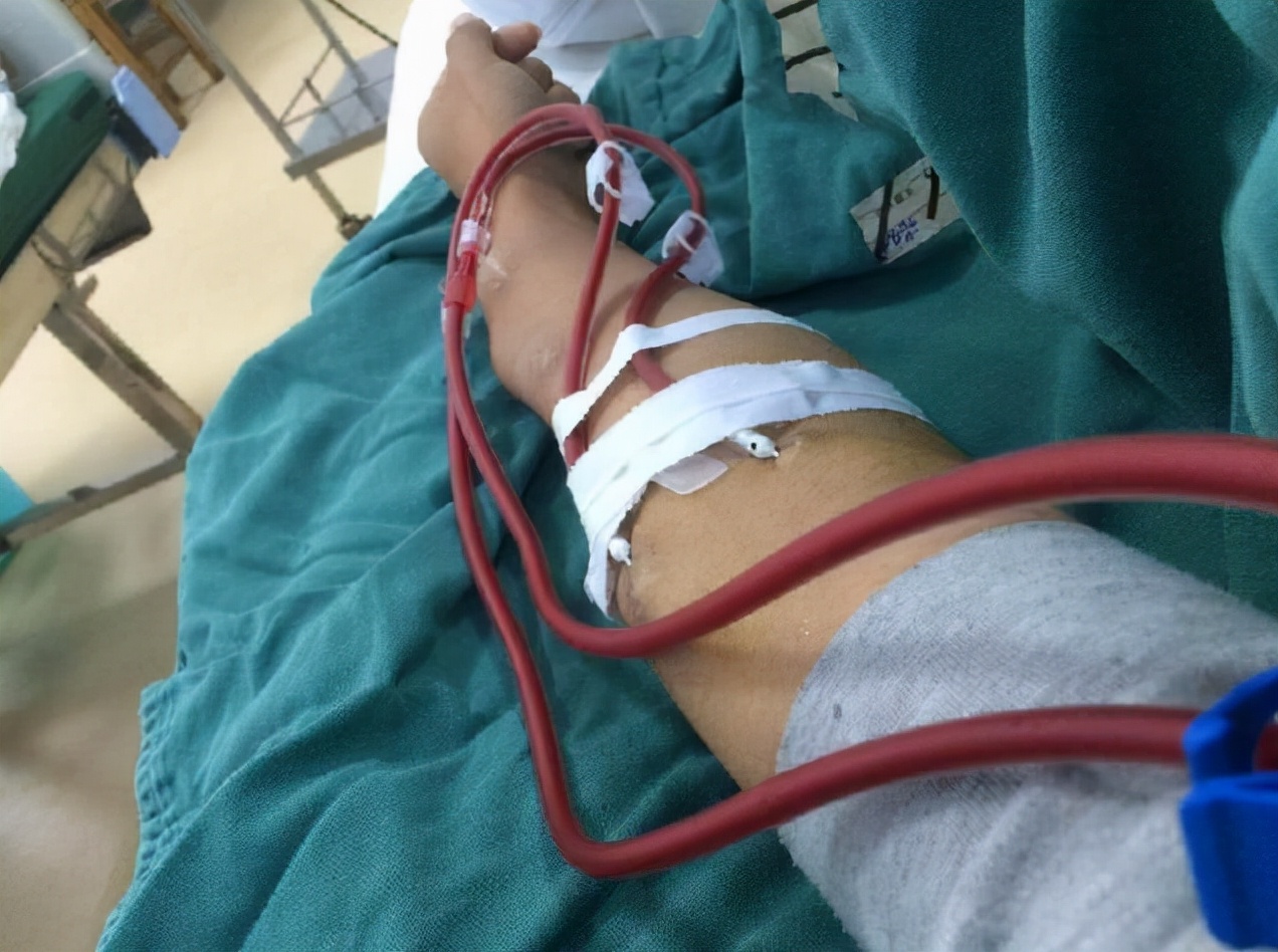 a型b型ab型o型哪种血型体质最好,a型b型ab型o型哪种血型性格较好