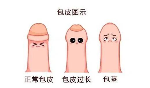 暑假来临，到底要不要带孩子去割包皮？