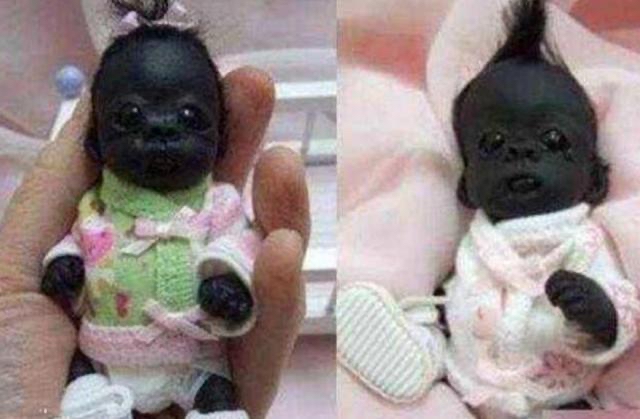 世界上最黑的婴儿眼睛都看不见了,世界上最黑的宝宝现在过的怎么样