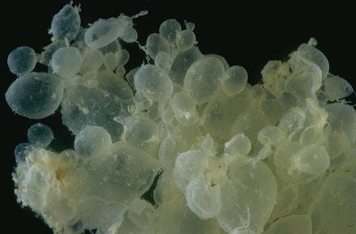 杭州33岁二胎宝妈孕期“癌”爬进脑，没想到竟是胎儿惹的祸