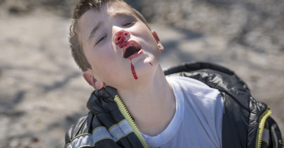 流鼻血的恐怖现象,流鼻血恐怖案例