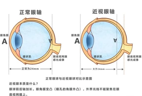 智瞳护眼小知识,学习护眼的知识