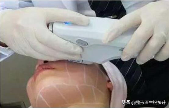 法令纹打玻尿酸还是做线雕效果好,线雕和玻尿酸祛除法令纹哪个好