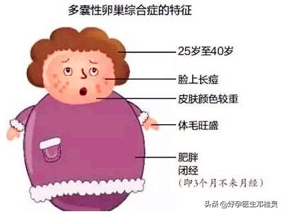 体检b超能查出来多囊卵巢,女性检查出来多囊