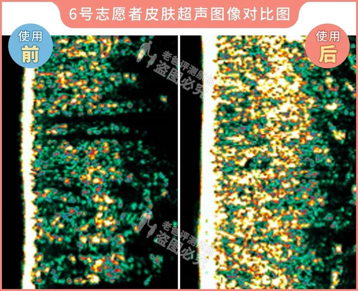 测评家用美容仪真的有用吗,网红推荐的美容仪有用吗