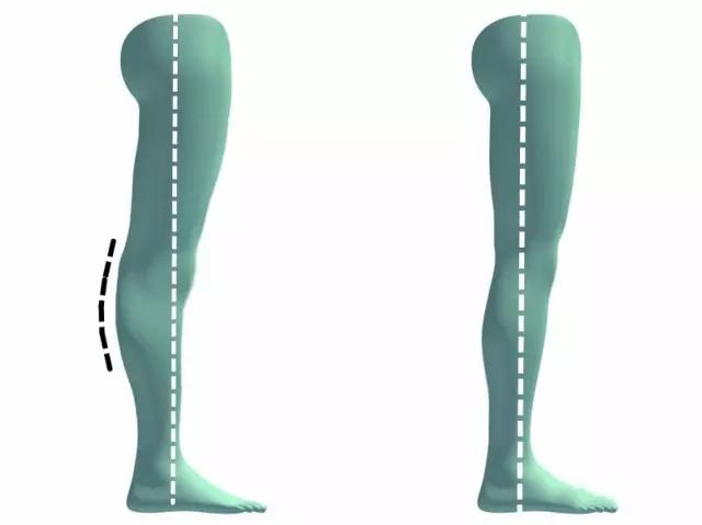 三个正确的弯腿方法图解,怎样练习才能把弯腿练成直腿
