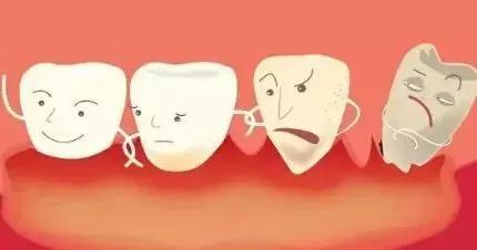 烤瓷牙需要把旁边牙齿全弄掉嘛,烤瓷牙拆出来什么情况下不用打桩
