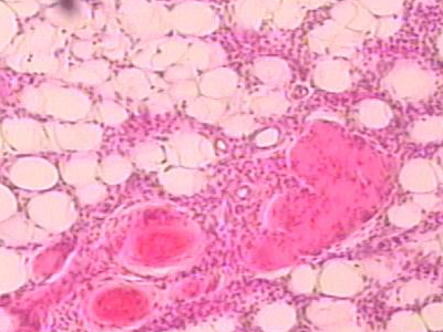 想要减掉大肚子吃什么肉,想减小肚腩