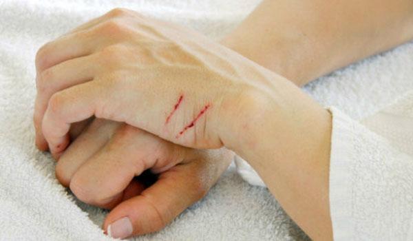 破伤风需要注射破伤风抗毒素吗,破伤风抗毒素要在外伤后多久注射