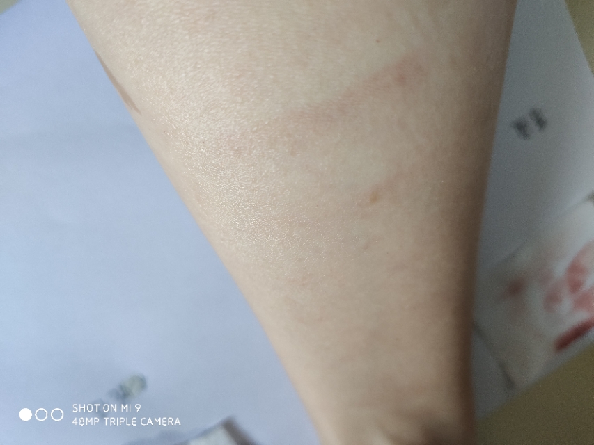 蓓昂斯卸妆水和贝德玛哪个好,集美们ulike和慕金哪个好