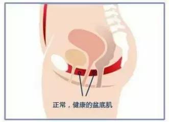 笑会流尿出来是什么原因,笑尿了正常吗健康科普