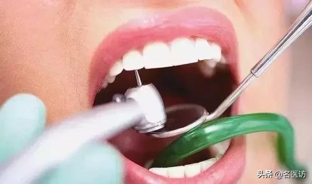 需要根管治疗的牙是什么症状,医生怎么判断是否需要根管治疗