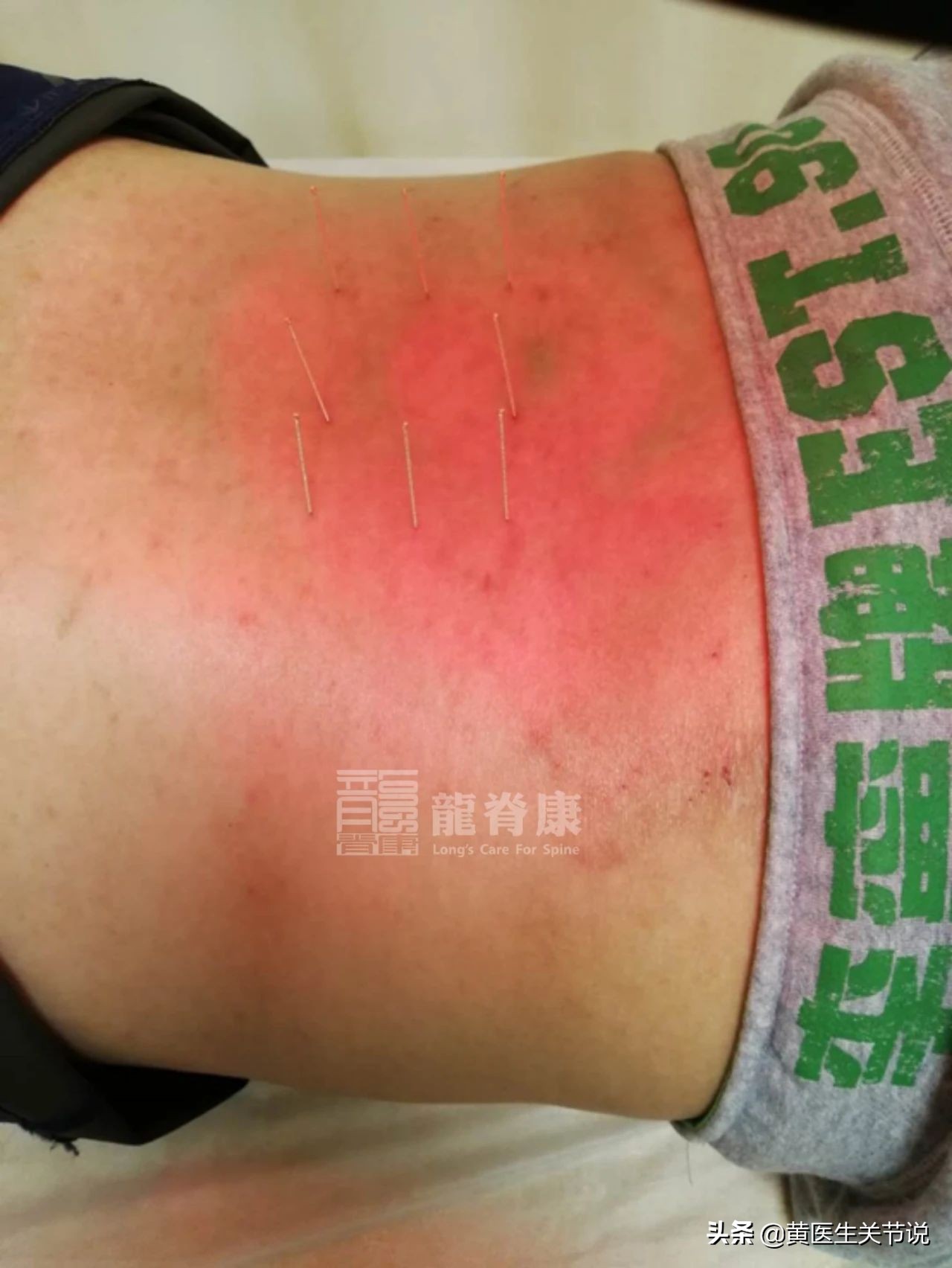 办公室久坐腰痛的缓解方法,久坐腰痛背疼的缓解方法