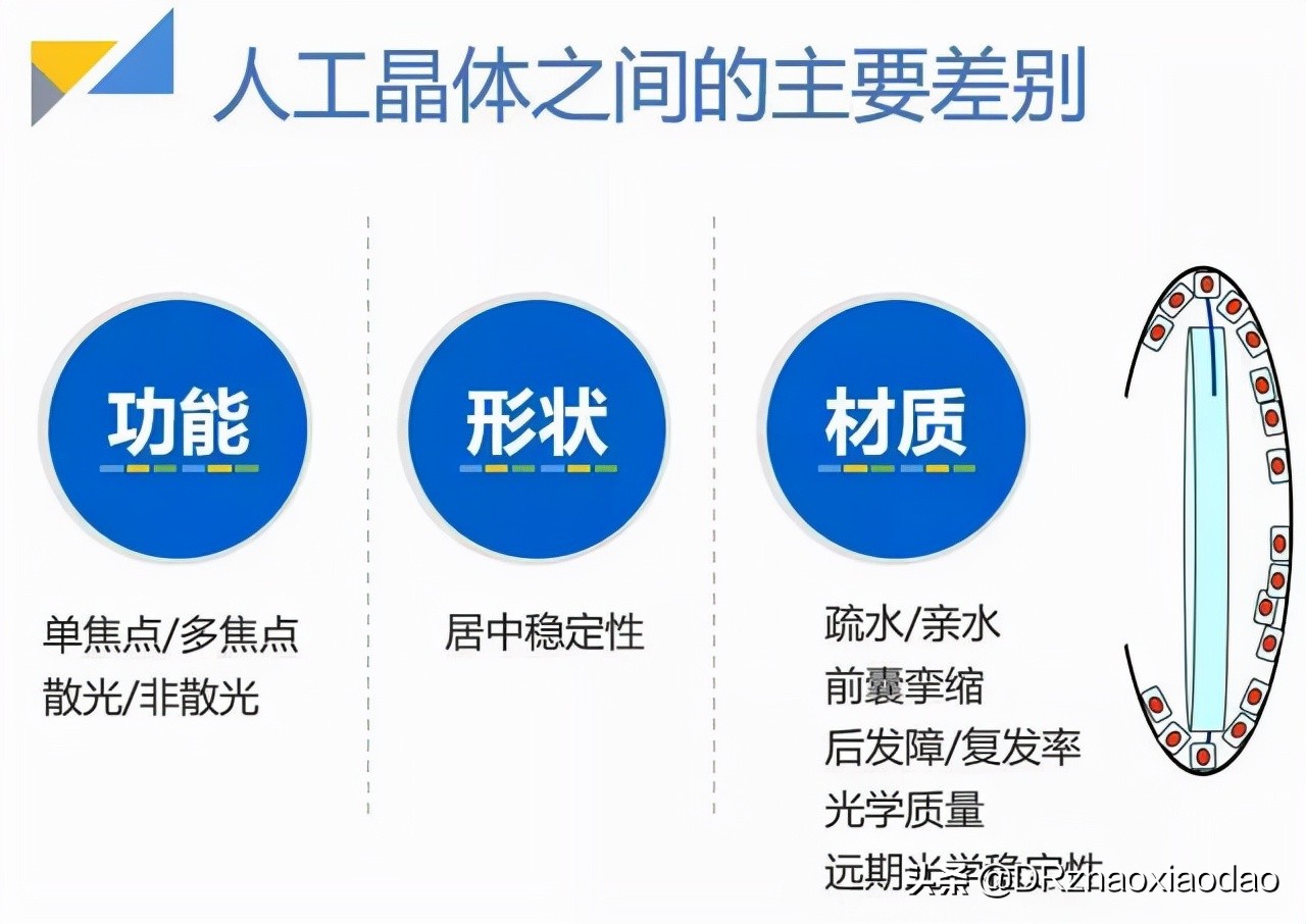 白内障手术人工晶体选择,白内障手术人工晶体是怎么做的