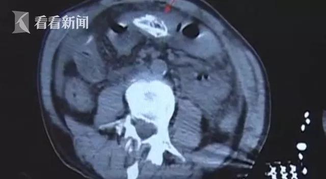 男子探险意外发现洞穴奇异生物,男子潜水意外发现7米长巨蛇