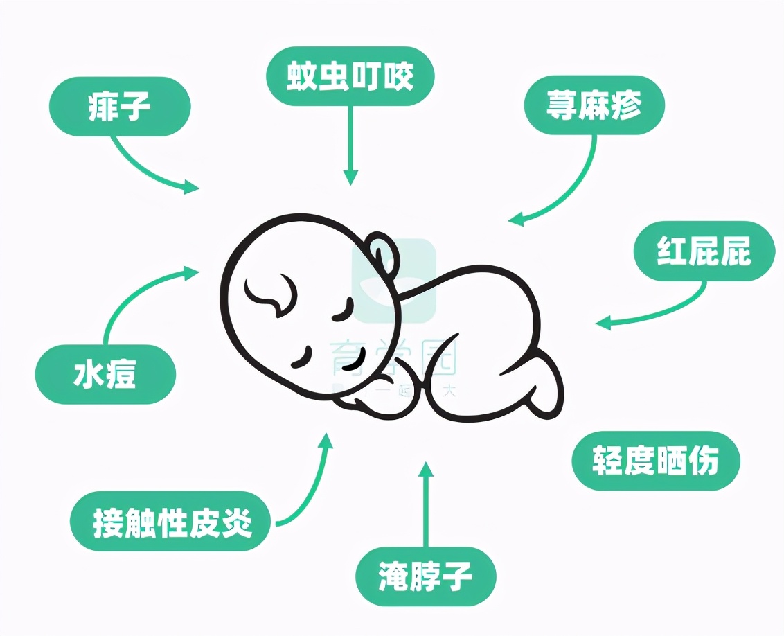 炉甘石剂的使用方法什么时候用,炉甘石的禁忌人群与使用剂量