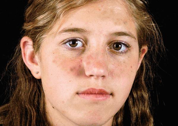 祛斑产品是交智商税吗,577祛斑是智商税吗