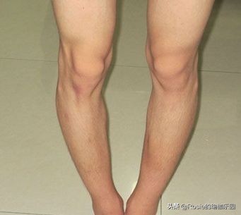 真翘臀和假翘臀怎么辨别,翘臀本来就有点骨盆前倾吗