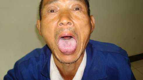 如何判断是不是胃火,如何判断有没有胃火