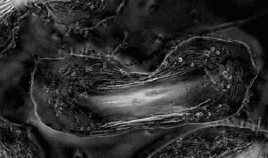 她拥有永生，靠此造福10亿人，死于癌症后，她的细胞带她重生！