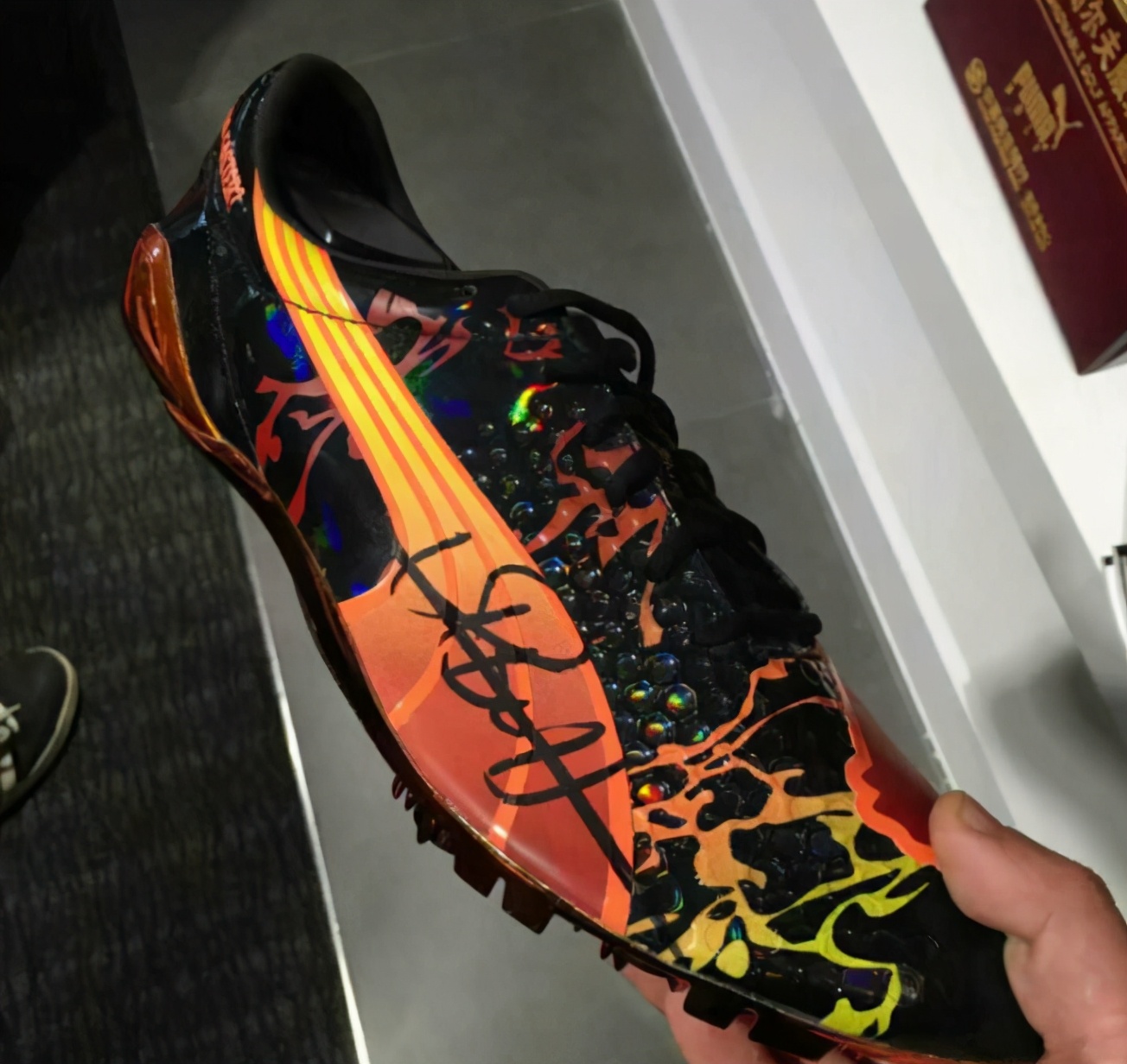 博尔特脚变形,博尔特现在变成了什么