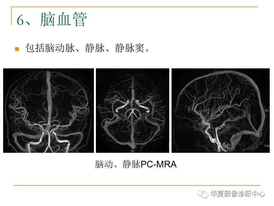 中国人脑立体定向mri应用解剖图谱,脑mri示意图