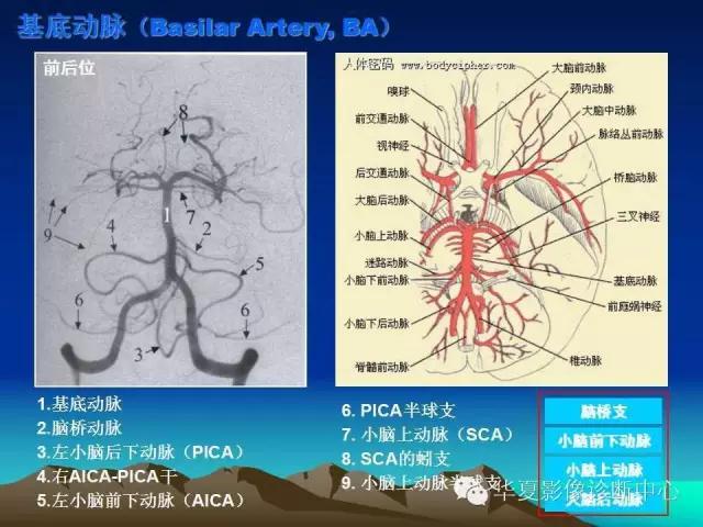 小脑血管解剖分段,脑血管影像解剖讲解