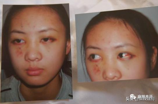 童瑶被张默打时照片,童瑶拿下冠军