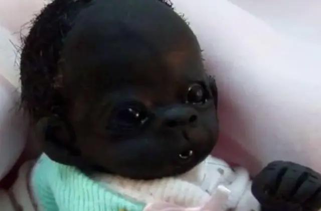 世界上最黑的女婴是谁,最黑的婴儿现在怎样了