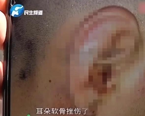 airpods爆炸耳出血,苹果耳机airpods爆炸事件