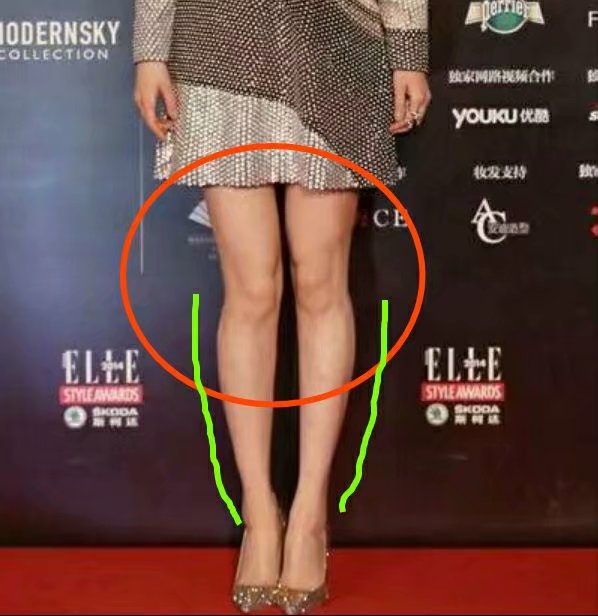 扁平足穿什么鞋都痛吗,扁平足穿什么鞋可以矫正