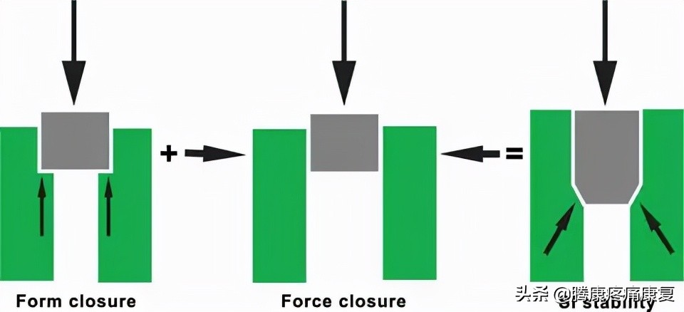骶髂关节疼痛的原因一般是什么,骶髂关节夜间疼痛口服什么药品
