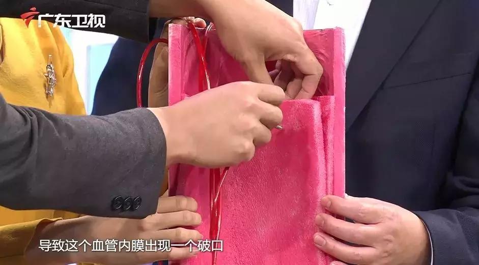 主动脉夹层手术后会猝死吗,主动脉夹层破裂猝死有救吗