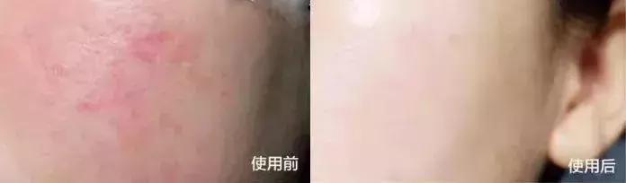 沈梦辰美妆精华,沈梦辰全靠这款精华液逆袭变白